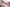 The Silent Night Problem Nobody Talks About But Everyone Hears, Snoring in India
