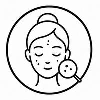 Acne-Prone Skin