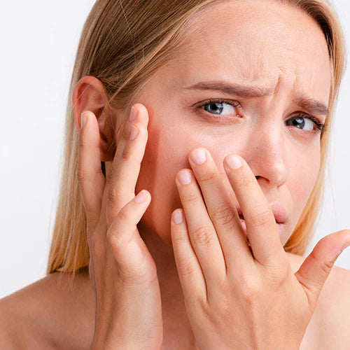 SKIN INFLAMMATIONAND REDNESS ?